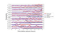 Estats preictals d'alta connectivitat en l'epilèpsia: evidència d'EEG intracranial, interacció amb la zona d'inici de les convulsions i modelatge de xarxes