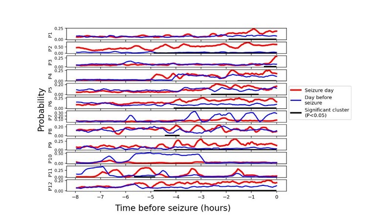 Preictal high-connectivity states in epilepsy: Evidence of intracranial EEG, interplay with the seizure onset zone and network modeling