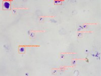 Desarrollo de un sistema de diagnóstico automatizado por la malaria y la esquistosomiasis urogenital utilizando herramientas de inteligencia artificial y un microscopio robotizado universal de bajo coste